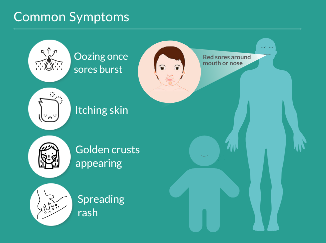 Category Content Test Image