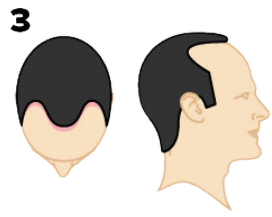 Example Blocks Service Image