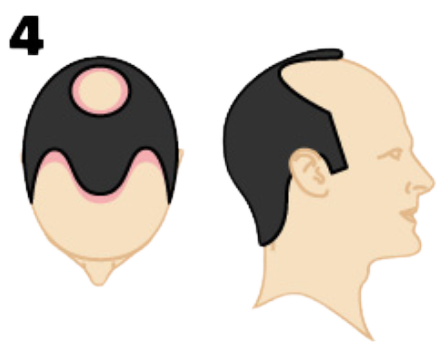 Example Blocks Service Image