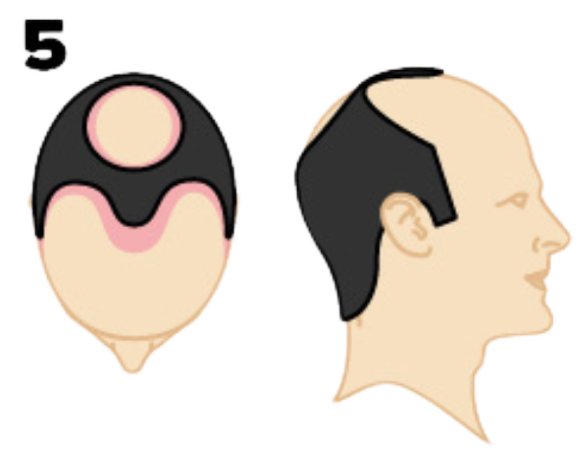 Example Blocks Service Image