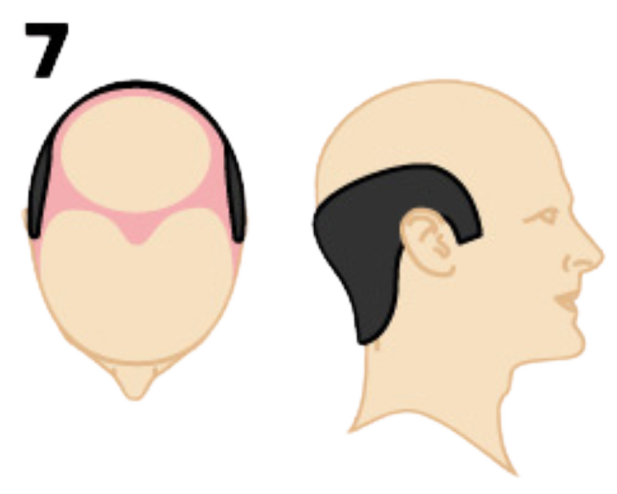 Example Blocks Service Image